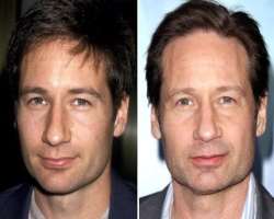 David Duchovny before surgery